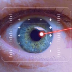 c2da7985-6ab0-4210-b0c2-de6ecec2c69f.jpg Refraktive-Augenlaserchirurgie („Augenlasern“) und Keratokonus Behandlung