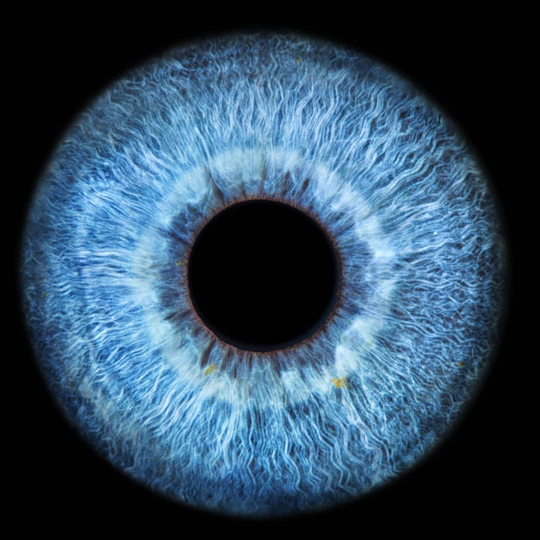 Blaues Auge – Makuladegeneration Wien